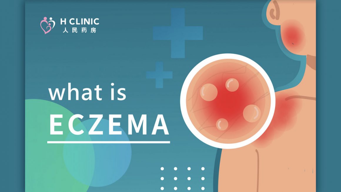 What is ECZEMA?